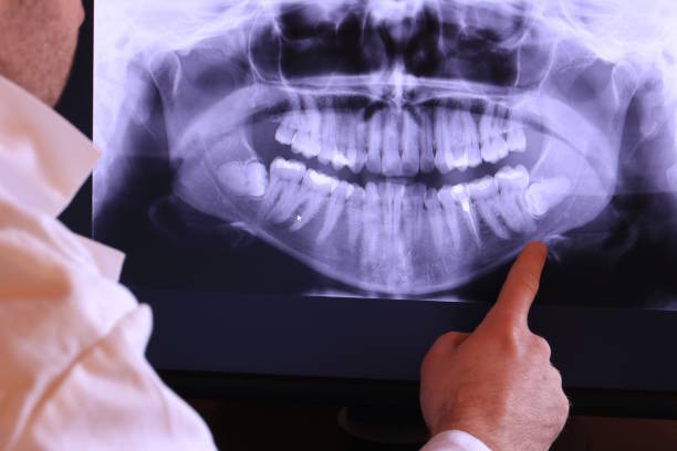 Best Emergency Dental Surgery in Reed Creek, GA