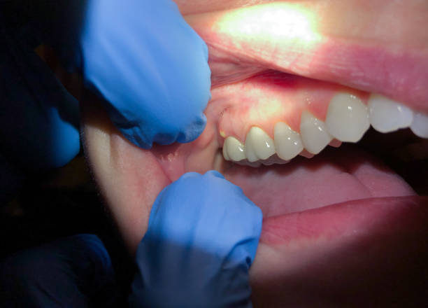 Best Walk-In Emergency Dentist in Reed Creek, GA